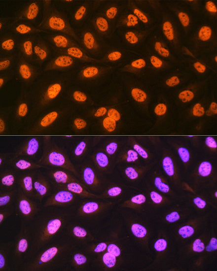 hnRNP C Rabbit mAb