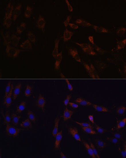[KO Validated] SUCLG2 Rabbit pAb