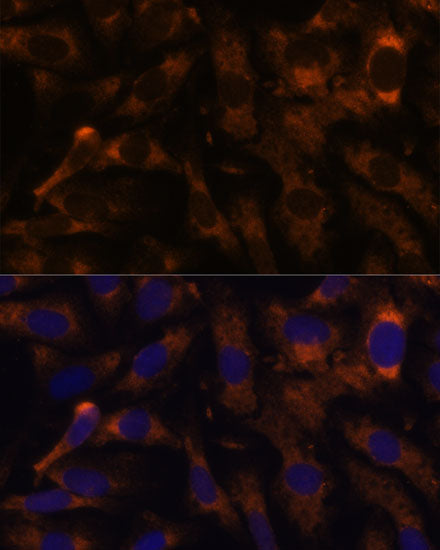 [KO Validated] SUCLG2 Rabbit pAb