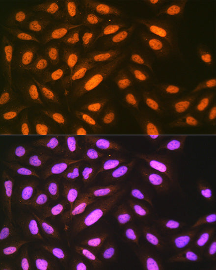 eIF4A3 Rabbit mAb
