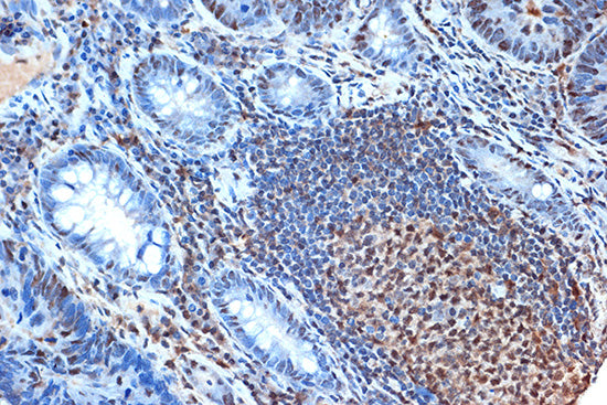 FEN-1 Rabbit mAb