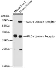 67kDa Laminin Receptor Rabbit pAb