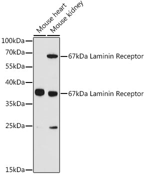 67kDa Laminin Receptor Rabbit pAb
