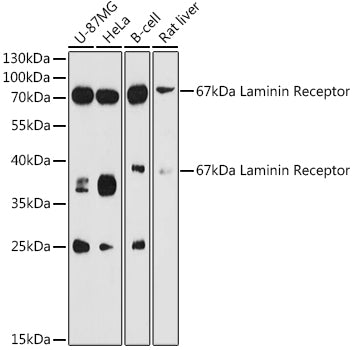 67kDa Laminin Receptor Rabbit pAb