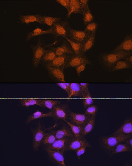 67kDa Laminin Receptor Rabbit pAb