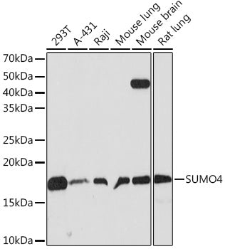 SUMO4 Rabbit mAb