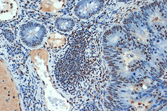 SUMO4 Rabbit mAb
