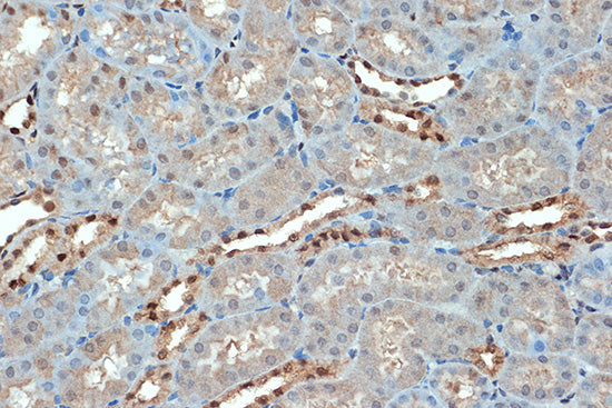 SUMO4 Rabbit mAb