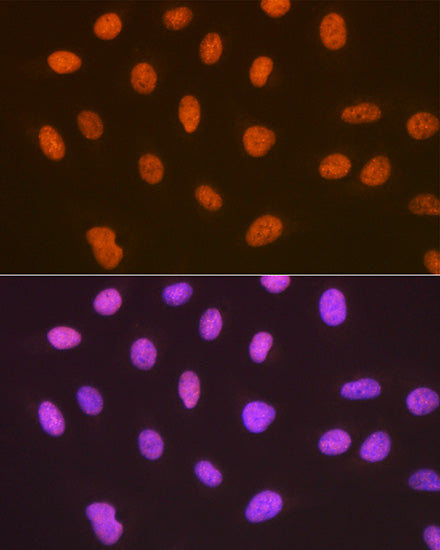 SUMO4 Rabbit mAb