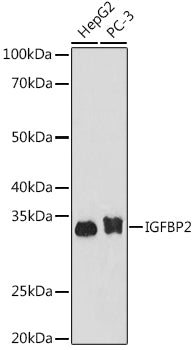 IGFBP2 Rabbit mAb