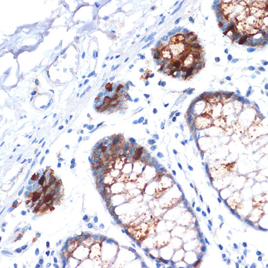 IGFBP2 Rabbit mAb