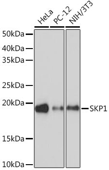 SKP1 Rabbit mAb