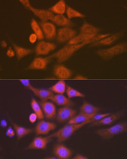 SKP1 Rabbit mAb