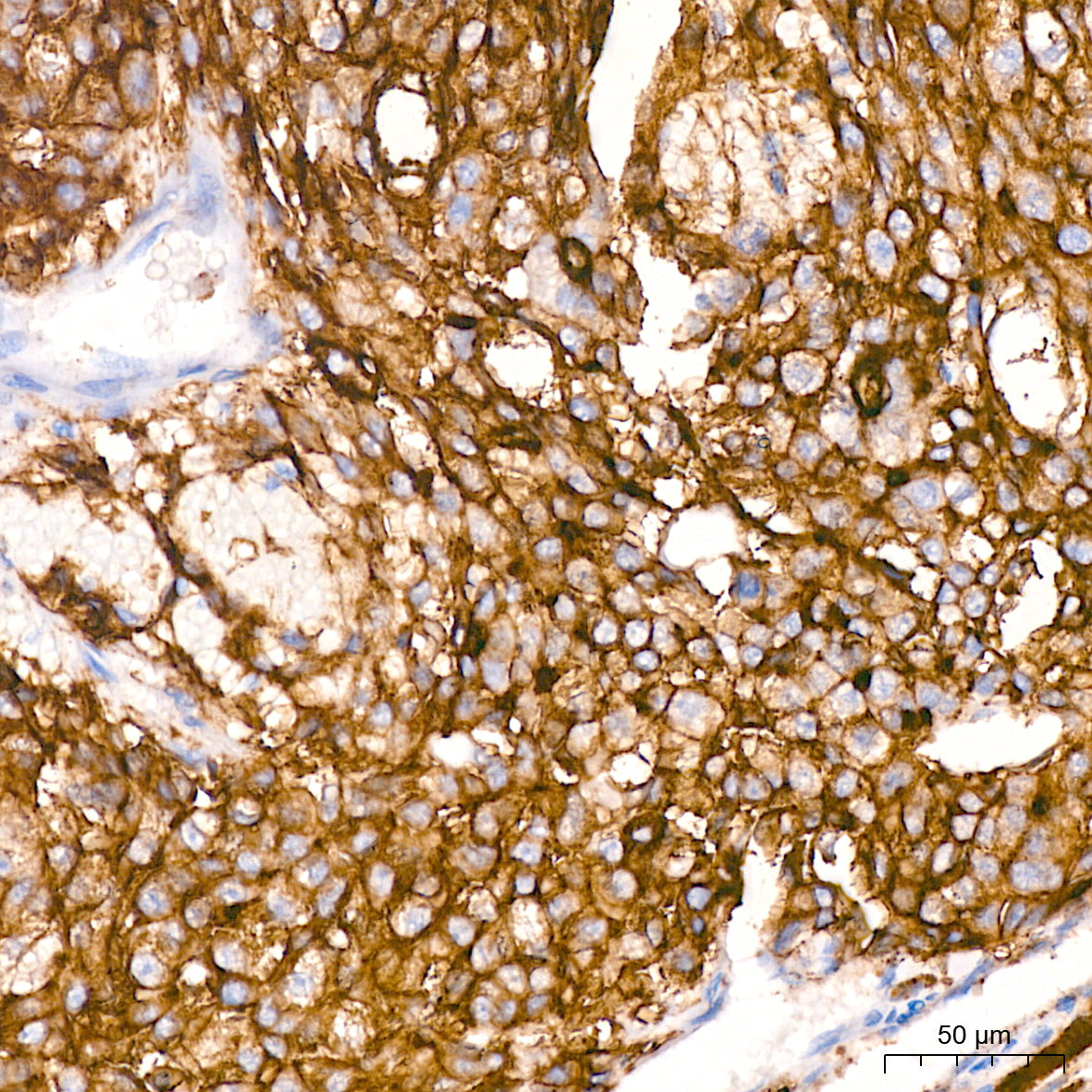 Xanthine Oxidase (XDH) Rabbit mAb