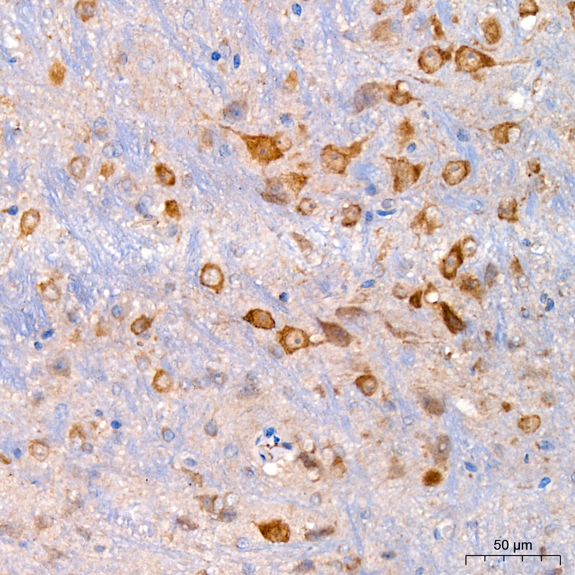 Xanthine Oxidase (XDH) Rabbit mAb