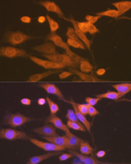 Xanthine Oxidase (XDH) Rabbit mAb