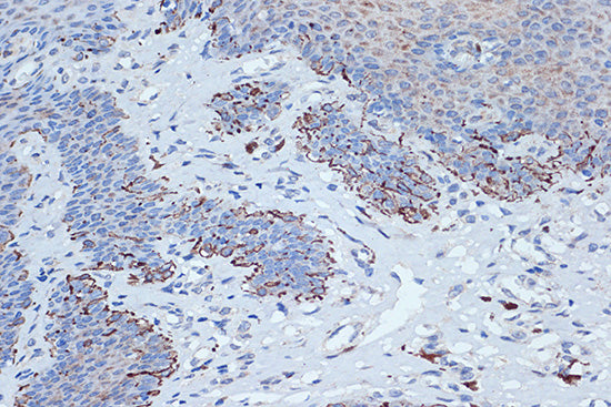 STK3/MST2 Rabbit mAb