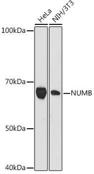 NUMB Rabbit mAb