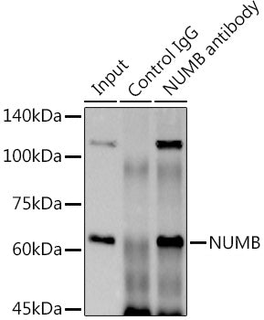 NUMB Rabbit mAb
