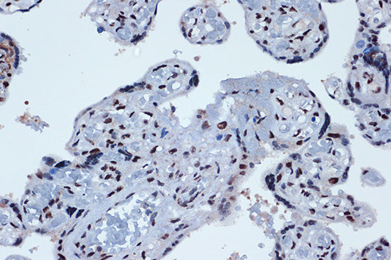 PROX1 Rabbit mAb