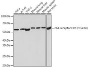 PGE receptor EP2 (PTGER2) Rabbit mAb