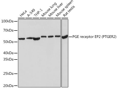 PGE receptor EP2 (PTGER2) Rabbit mAb