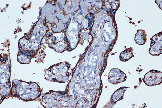 PGE receptor EP2 (PTGER2) Rabbit mAb