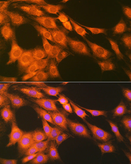 PGE receptor EP2 (PTGER2) Rabbit mAb