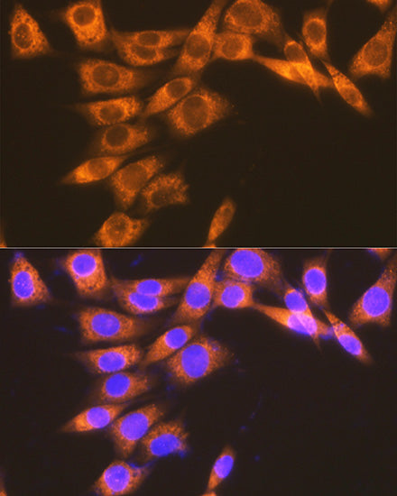 PGE receptor EP2 (PTGER2) Rabbit mAb