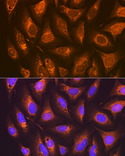 PGE receptor EP2 (PTGER2) Rabbit mAb