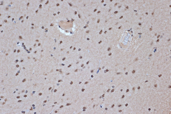 SRSF3 Rabbit mAb