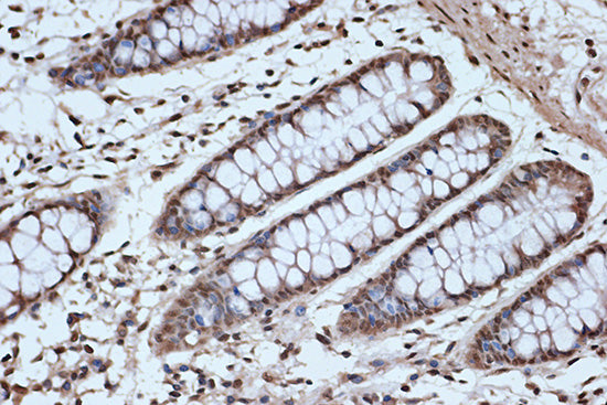SRSF3 Rabbit mAb