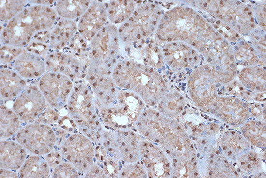 SRSF3 Rabbit mAb