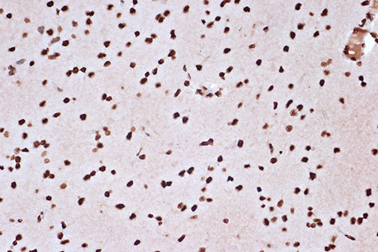 macroH2A.1 Rabbit mAb