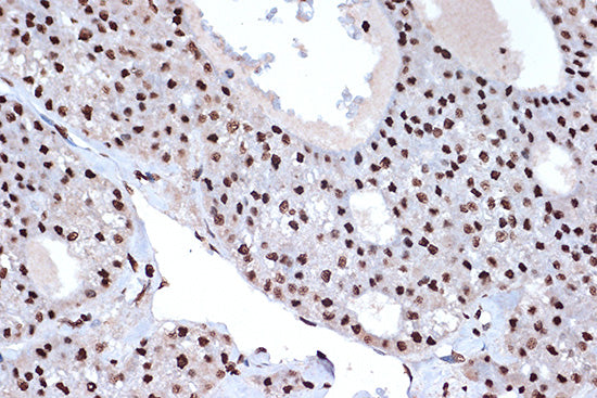 macroH2A.1 Rabbit mAb