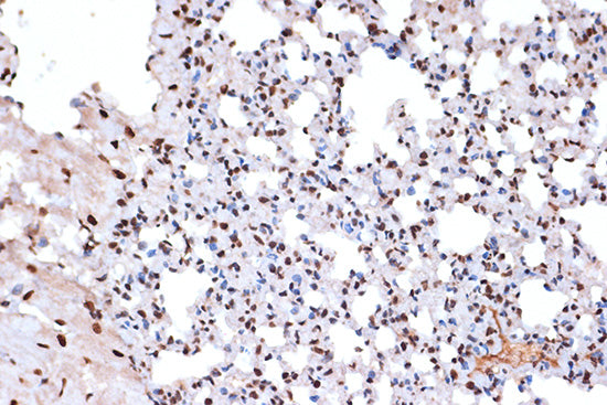 macroH2A.1 Rabbit mAb