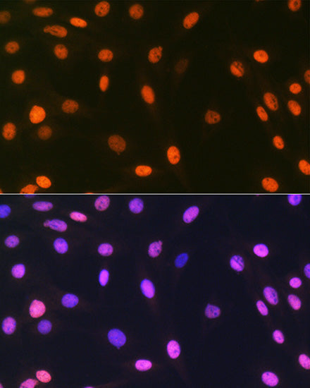 macroH2A.1 Rabbit mAb