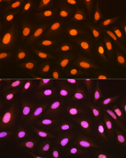 macroH2A.1 Rabbit mAb