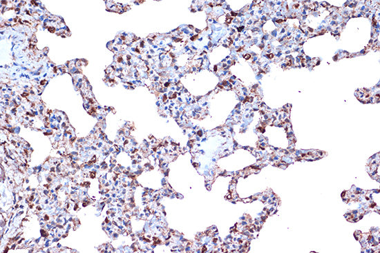PDCD4 Rabbit mAb