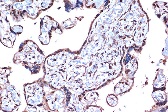 PDCD4 Rabbit mAb