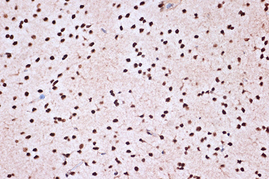 KHSRP Rabbit mAb
