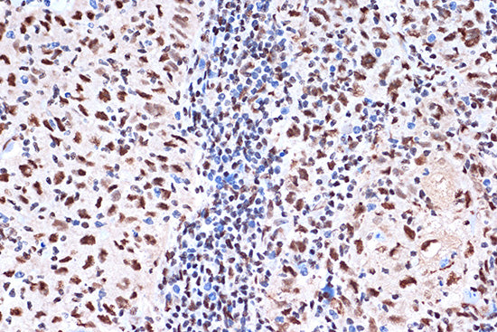 KHSRP Rabbit mAb