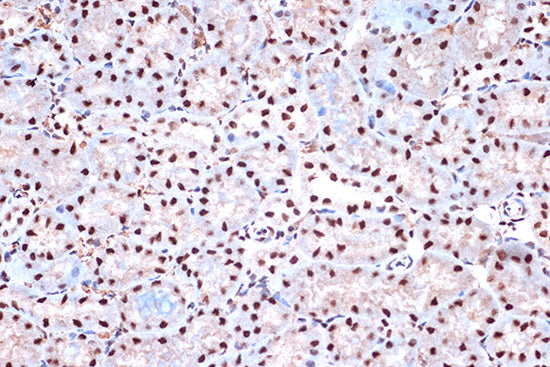 KHSRP Rabbit mAb