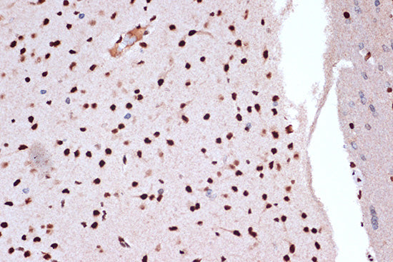 FUBP1 Rabbit mAb