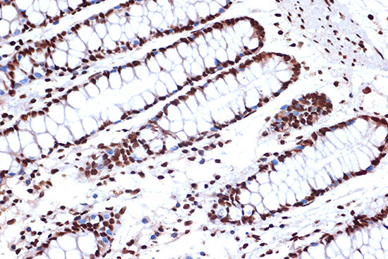 FUBP1 Rabbit mAb