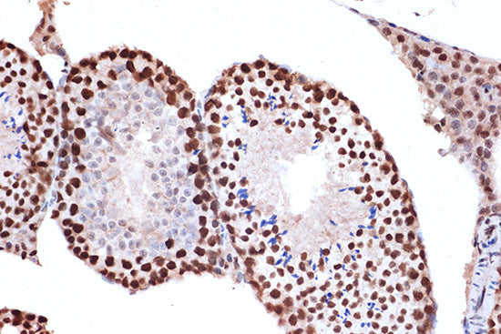 FUBP1 Rabbit mAb