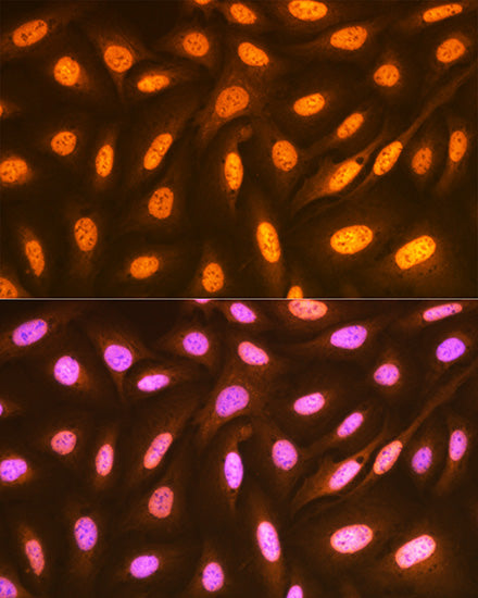 FUBP1 Rabbit mAb