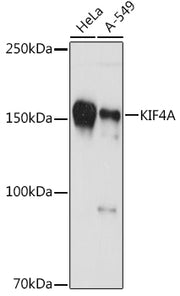 KIF4A Rabbit mAb