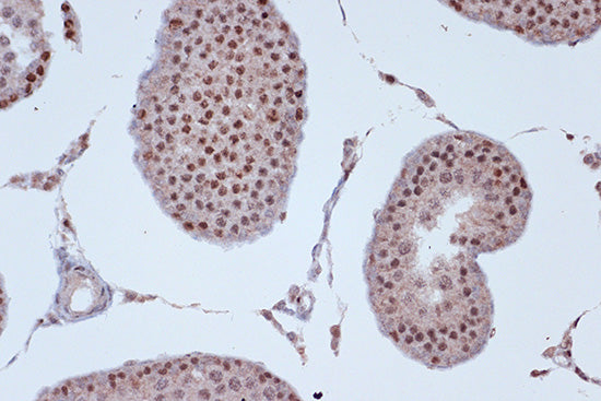 KIF4A Rabbit mAb