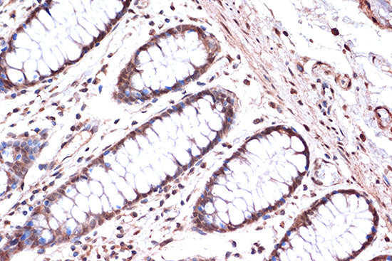 KIF4A Rabbit mAb